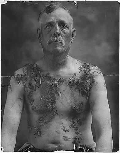Tarred and Feathered